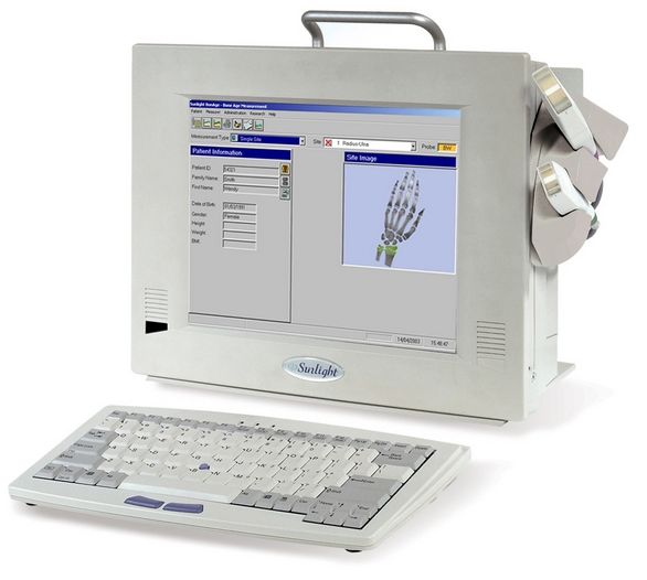 Densytometry ultradźwiękowe Sunlight Omnisense 8000S
