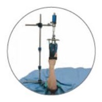 Dystraktory nadgarstka do artroskopii Smith&Nephew Wrist Tower