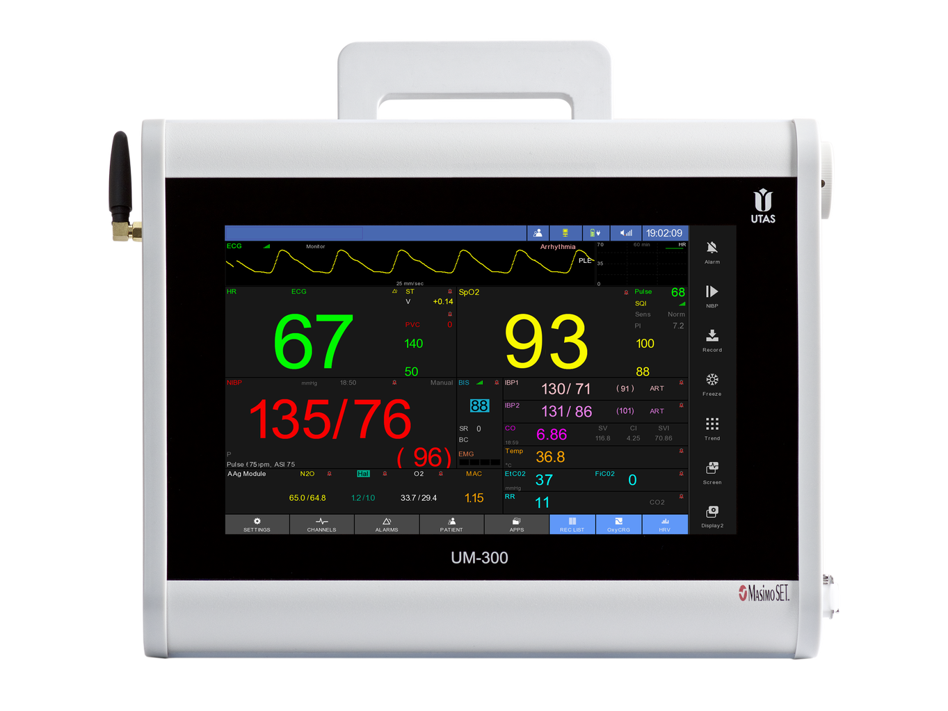 Kardiomonitory przyłóżkowe UTAS UM 300-S