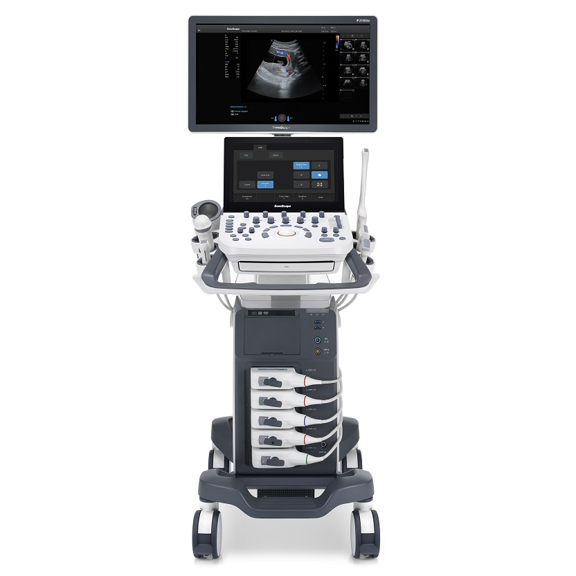 Ultrasonografy stacjonarne wielonarządowe - USG SonoScape P20 Elite