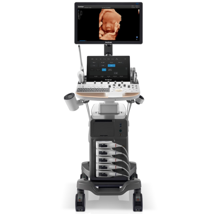 Ultrasonografy stacjonarne wielonarządowe - USG SonoScape P60