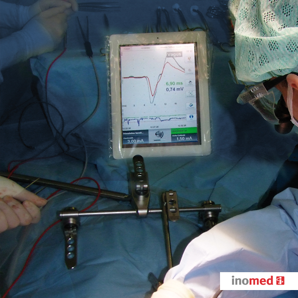 Aparaty do neurostymulacji i neuromonitoringu śródoperacyjnego inomed Medizintechnik GmbH Monitor Nerwów C2