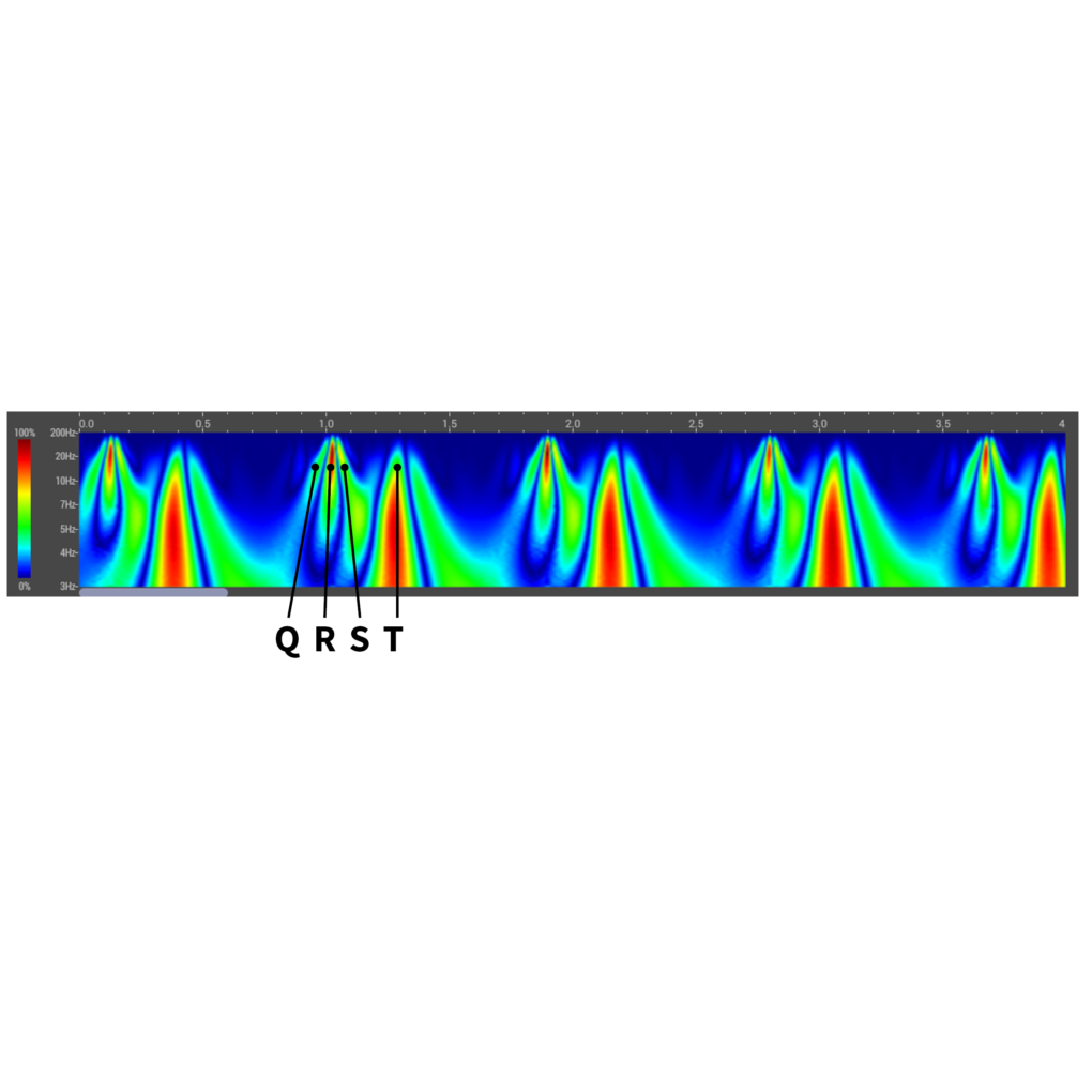 Aparaty EKG - Elektrokardiografy HeartSciences Myovista