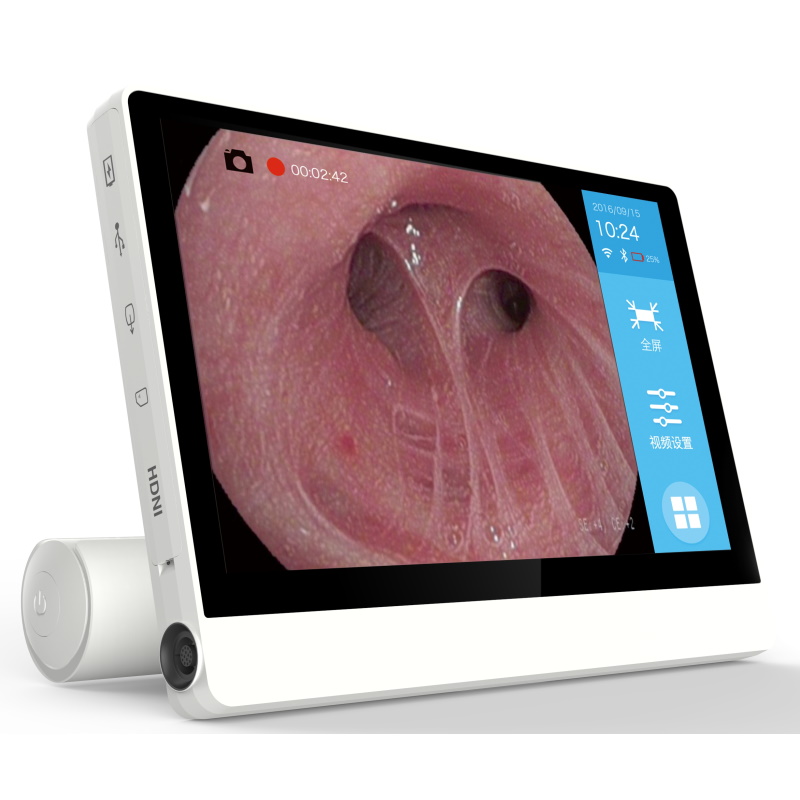 Nasofaryngoskopy Vision Medical EF28