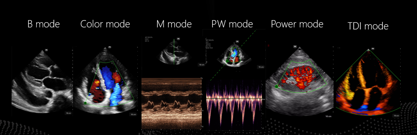 Ultrasonografy kieszonkowe ręczne (USG) MINDRAY TE Air