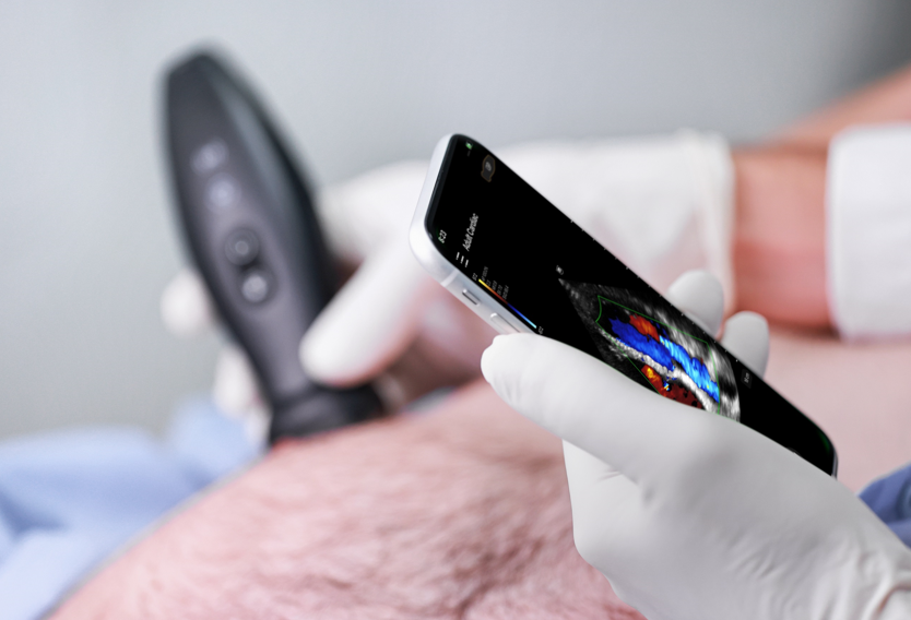 Ultrasonografy kieszonkowe ręczne (USG) MINDRAY TE Air