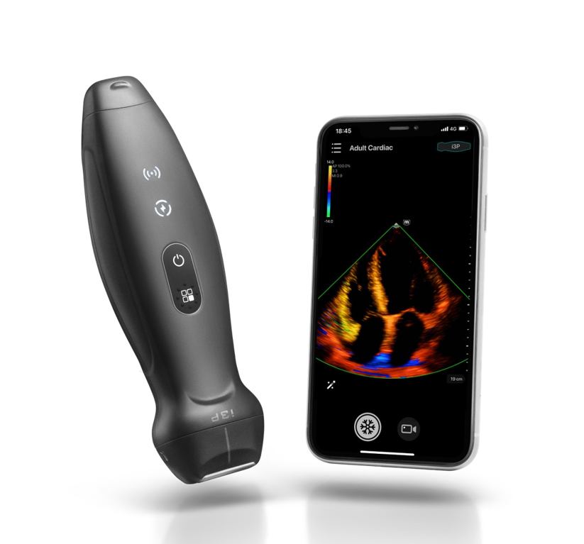 Ultrasonografy kieszonkowe ręczne (USG) MINDRAY TE Air