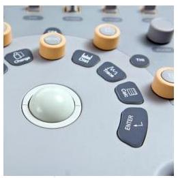 Ultrasonografy stacjonarne wielonarządowe - USG CHISON i3