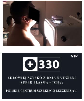 Urządzenia do fototerapii ginekologicznej Super Plasma JCH33