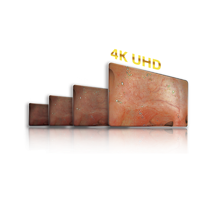 Zestaw  videoendoskopowy - gastroskopowo-kolonoskopowy AOHUA AQ300