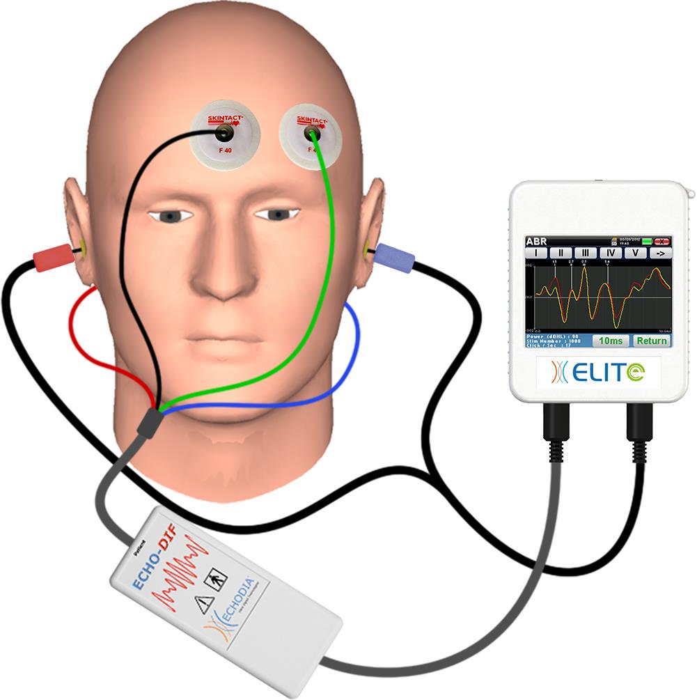 Słuchowe potencjały wywołane ABR/BERA