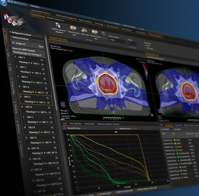 Oprogramowanie do radioterapii